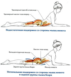 Разгибание спины лежа на животе